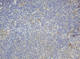 F13A1 / Factor XIIIa Antibody - IHC of paraffin-embedded Human lymph node tissue using anti-F13A1 mouse monoclonal antibody.