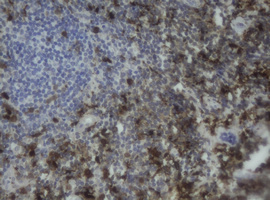 F13A1 / Factor XIIIa Antibody - IHC of paraffin-embedded Human lymph node tissue using anti-F13A1 mouse monoclonal antibody.