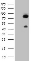 F13A1 / Factor XIIIa Antibody - HEK293T cells were transfected with the pCMV6-ENTRY control (Left lane) or pCMV6-ENTRY F13A1 (Right lane) cDNA for 48 hrs and lysed. Equivalent amounts of cell lysates (5 ug per lane) were separated by SDS-PAGE and immunoblotted with anti-F13A1.