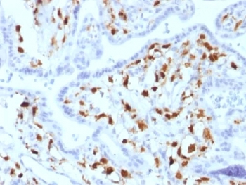 F13A1 / Factor XIIIa Antibody - IHC testing of FFPE human placenta with Factor XIIIa antibody (clone SPM180). Required HIER: boil tissue sections in 10mM citrate buffer, pH 6, for 10-20 min.