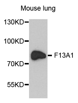 F13A1 / Factor XIIIa Antibody - Western blot analysis of extract of various cells.
