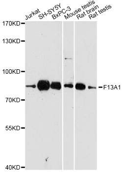 F13A1 / Factor XIIIa Antibody - Western blot analysis of extracts of various cell lines, using F13A1 antibody at 1:3000 dilution. The secondary antibody used was an HRP Goat Anti-Rabbit IgG (H+L) at 1:10000 dilution. Lysates were loaded 25ug per lane and 3% nonfat dry milk in TBST was used for blocking. An ECL Kit was used for detection and the exposure time was 30s.