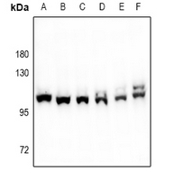 F13A1 / Factor XIIIa Antibody - Western blot analysis of Factor XIIIa expression in mouse testis (A), rat testis (B), K562 (C), EC9706 (D), MCF7 (E), HCT116 (F) whole cell lysates.