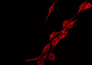 F13A1 / Factor XIIIa Antibody - Staining HeLa cells by IF/ICC. The samples were fixed with PFA and permeabilized in 0.1% Triton X-100, then blocked in 10% serum for 45 min at 25°C. The primary antibody was diluted at 1:200 and incubated with the sample for 1 hour at 37°C. An Alexa Fluor 594 conjugated goat anti-rabbit IgG (H+L) Ab, diluted at 1/600, was used as the secondary antibody.