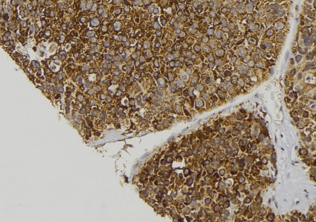 F13A1 / Factor XIIIa Antibody - 1:100 staining human pancreas tissue by IHC-P. The sample was formaldehyde fixed and a heat mediated antigen retrieval step in citrate buffer was performed. The sample was then blocked and incubated with the antibody for 1.5 hours at 22°C. An HRP conjugated goat anti-rabbit antibody was used as the secondary.