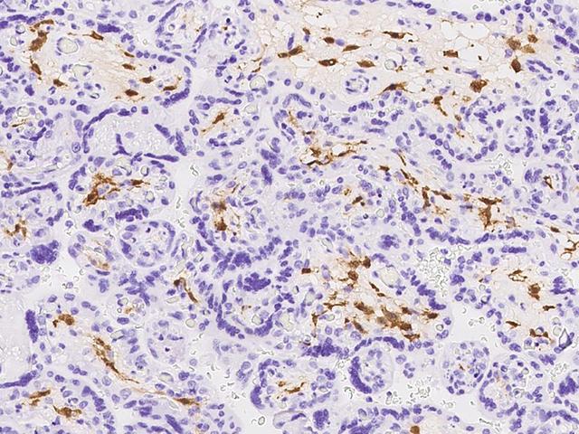 F13A1 / Factor XIIIa Antibody - Immunochemical staining of human F13A1 in human placenta with rabbit polyclonal antibody at 1:2000 dilution, formalin-fixed paraffin embedded sections.