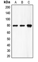 F13A1 / Factor XIIIa Antibody - Western blot analysis of Factor XIII A expression in HeLa (A); A549 (B); rat heart (C) whole cell lysates.