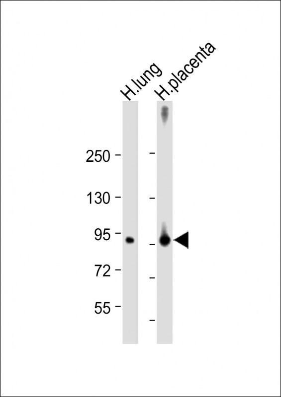 F13A1 / Factor XIIIa Antibody - All lanes: Anti-F13A1 Antibody (N-Term) at 1:2000 dilution Lane 1: Human lung lysate Lane 2: Human placenta lysate Lysates/proteins at 20 µg per lane. Secondary Goat Anti-Rabbit IgG, (H+L), Peroxidase conjugated at 1/10000 dilution. Predicted band size: 83 kDa Blocking/Dilution buffer: 5% NFDM/TBST.