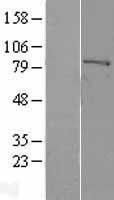 F13A1 / Factor XIIIa Protein - Western validation with an anti-DDK antibody * L: Control HEK293 lysate R: Over-expression lysate