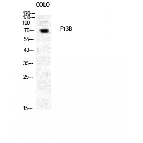 F13B / TGase Antibody - Western blot of Factor XIII B antibody