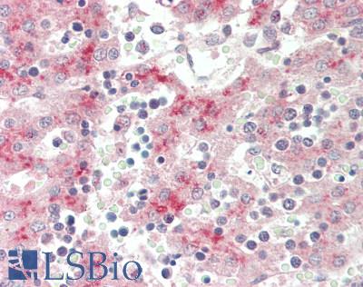 F13B / TGase Antibody - Human Fetal Liver: Formalin-Fixed, Paraffin-Embedded (FFPE).  This image was taken for the unconjugated form of this product. Other forms have not been tested.