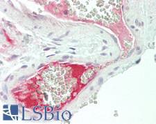 F13B / TGase Antibody - Human Colon, Vessel: Formalin-Fixed, Paraffin-Embedded (FFPE).  This image was taken for the unconjugated form of this product. Other forms have not been tested.