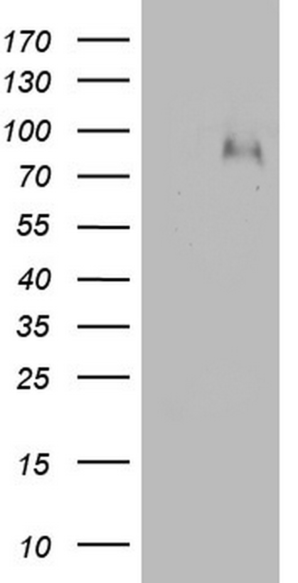 F13B / TGase Antibody - HEK293T cells were transfected with the pCMV6-ENTRY control. (Left lane) or pCMV6-ENTRY F13B. (Right lane) cDNA for 48 hrs and lysed. Equivalent amounts of cell lysates. (5 ug per lane) were separated by SDS-PAGE and immunoblotted with anti-F13B.