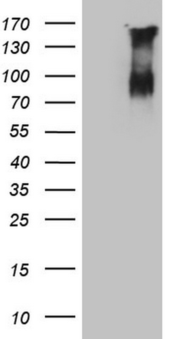 F13B / TGase Antibody - HEK293T cells were transfected with the pCMV6-ENTRY control. (Left lane) or pCMV6-ENTRY F13B. (Right lane) cDNA for 48 hrs and lysed. Equivalent amounts of cell lysates. (5 ug per lane) were separated by SDS-PAGE and immunoblotted with anti-F13B.