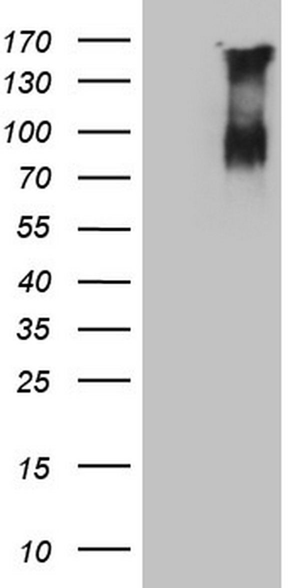 F13B / TGase Antibody - HEK293T cells were transfected with the pCMV6-ENTRY control (Left lane) or pCMV6-ENTRY F13B (Right lane) cDNA for 48 hrs and lysed. Equivalent amounts of cell lysates (5 ug per lane) were separated by SDS-PAGE and immunoblotted with anti-F13B.