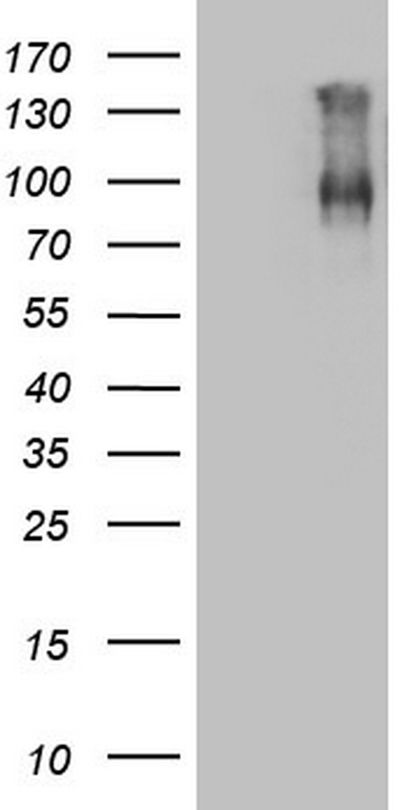 F13B / TGase Antibody - HEK293T cells were transfected with the pCMV6-ENTRY control. (Left lane) or pCMV6-ENTRY F13B. (Right lane) cDNA for 48 hrs and lysed. Equivalent amounts of cell lysates. (5 ug per lane) were separated by SDS-PAGE and immunoblotted with anti-F13B.