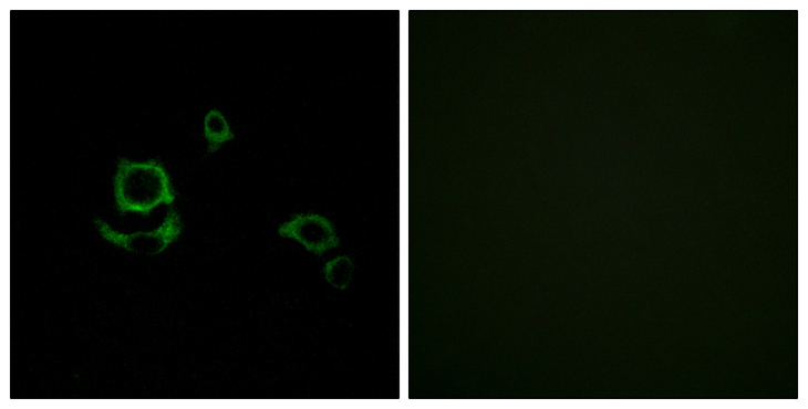 F13B / TGase Antibody - Immunofluorescence analysis of HUVEC cells, using F13B Antibody. The picture on the right is blocked with the synthesized peptide.