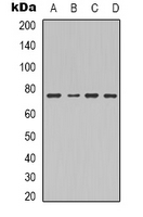 F13B / TGase Antibody - Western blot analysis of Factor XIII B expression in HeLa (A); mouse kidney (B); mouse heart (C); mouse liver (D) whole cell lysates.