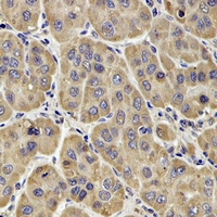 F13B / TGase Antibody - Immunohistochemical analysis of Factor XIII B staining in human liver formalin fixed paraffin embedded tissue section. The section was pre-treated using heat mediated antigen retrieval with sodium citrate buffer (pH 6.0). The section was then incubated with the antibody at room temperature and detected using an HRP polymer system. DAB was used as the chromogen. The section was then counterstained with hematoxylin and mounted with DPX.