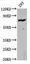 F13B / TGase Antibody - Western Blot Positive WB detected in: 293 whole cell lysate All Lanes: F13B antibody at 4.17µg/ml Secondary Goat polyclonal to rabbit IgG at 1/50000 dilution Predicted band size: 76 KDa Observed band size: 76 KDa