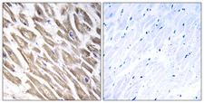 F13B / TGase Antibody - Immunohistochemistry analysis of paraffin-embedded human heart tissue, using F13B Antibody. The picture on the right is blocked with the synthesized peptide.