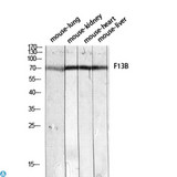F13B / TGase Antibody - Immunohistochemistry (IHC) analysis of paraffin-embedded Human Liver, antibody was diluted at 1:200.