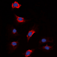 F13B / TGase Antibody - Immunofluorescent analysis of Factor XIII B staining in HEK293T cells. Formalin-fixed cells were permeabilized with 0.1% Triton X-100 in TBS for 5-10 minutes and blocked with 3% BSA-PBS for 30 minutes at room temperature. Cells were probed with the primary antibody in 3% BSA-PBS and incubated overnight at 4 ??C in a humidified chamber. Cells were washed with PBST and incubated with a DyLight 594-conjugated secondary antibody (red) in PBS at room temperature in the dark. DAPI was used to stain the cell nuclei (blue).