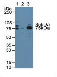 F2 / Prothrombin / Thrombin Antibody - Western Blot; Sample: Lane1: Rat Blood Cells; Lane2: Human Platelet Cells; Lane3: Rat Serum.