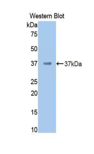 F2 / Prothrombin / Thrombin Antibody - Western blot of recombinant F2 / Prothrombin / Thrombin.  This image was taken for the unconjugated form of this product. Other forms have not been tested.
