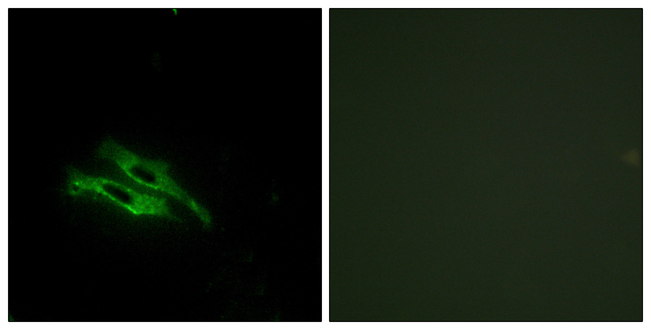 F2 / Prothrombin / Thrombin Antibody - Immunofluorescence analysis of NIH/3T3 cells, using THRB Antibody. The picture on the right is blocked with the synthesized peptide.