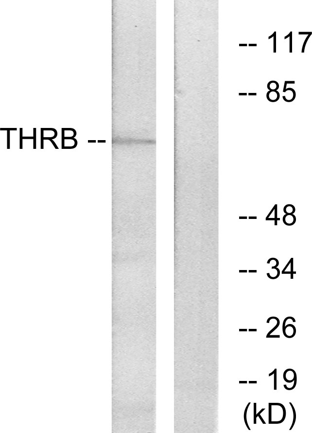 F2 / Prothrombin / Thrombin Antibody - Western blot analysis of lysates from NIH/3T3 cells, using THRB Antibody. The lane on the right is blocked with the synthesized peptide.