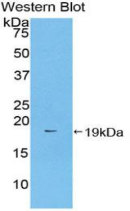 F2 / Prothrombin / Thrombin Antibody - Western blot of recombinant F2 / Prothrombin / Thrombin.  This image was taken for the unconjugated form of this product. Other forms have not been tested.