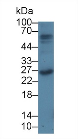 F2 / Prothrombin / Thrombin Antibody - Western Blot; Sample: Rat Thymus lysate; ;Primary Ab: 100 Mouse Anti-Rat PTHrP Antibody;Second Ab: 0.2µg/mL HRP-Linked Caprine Anti-Mouse IgG Polyclonal Antibody;