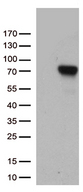 F2 / Prothrombin / Thrombin Antibody - HEK293T cells were transfected with the pCMV6-ENTRY control. (Left lane) or pCMV6-ENTRY F2. (Right lane) cDNA for 48 hrs and lysed. Equivalent amounts of cell lysates. (5 ug per lane) were separated by SDS-PAGE and immunoblotted with anti-F2. (1:500)