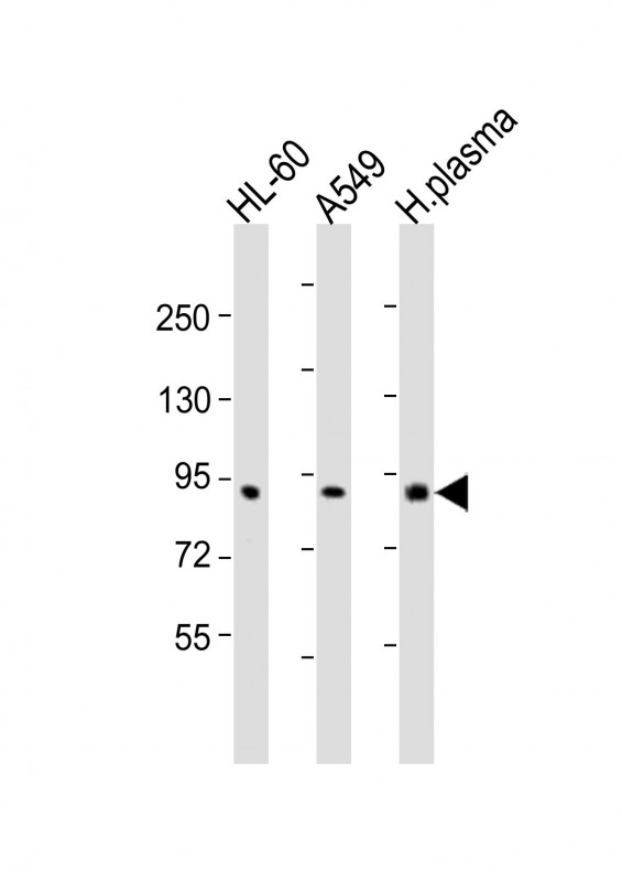 F2 / Prothrombin / Thrombin Antibody - All lanes: Anti-F2 Antibody (N-Term) at 1:2000 dilution. Lane 1: HL-60 whole cell lysates. Lane 2: A549 whole cell lysates. Lane 3: human plasma lysates Lysates/proteins at 20 ug per lane. Secondary Goat Anti-Rabbit IgG, (H+L), Peroxidase conjugated at 1:10000 dilution. Predicted band size: 70 kDa. Blocking/Dilution buffer: 5% NFDM/TBST.