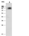 F2 / Prothrombin / Thrombin Antibody - Anti-F2 rabbit monoclonal antibody at 1:500 dilution. Lane A: Mouse kidney tissue lysate. Lysates/proteins at 30 ug per lane. Secondary: Goat Anti-Rabbit IgG (H+L)/HRP at 1/10000 dilution. Developed using the ECL technique. Performed under reducing conditions. Predicted band size: 70 kDa. Observed band size: 90 kDa.