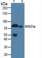 F2 / Prothrombin / Thrombin Antibody - Western Blot; Sample: Lane1: Rat Serum; Lane2: Rat Liver Tissue.