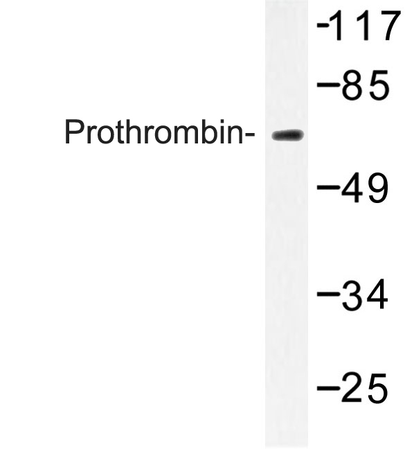 F2 / Prothrombin / Thrombin Antibody - Western blot of Prothrombin (G724) pAb in extracts from NIH-3T3 cells.