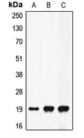 F2 / Prothrombin / Thrombin Antibody - Western blot analysis of Factor II APII expression in THP1 UV-treated (A); mouse liver (B); rat liver (C) whole cell lysates.