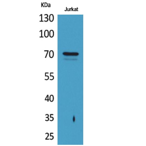 F2 / Prothrombin / Thrombin Antibody - Western blot of Prothrombin antibody