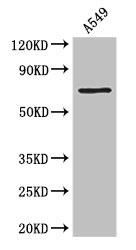 F2 / Prothrombin / Thrombin Antibody - Western Blot Positive WB detected in: A549 whole cell lysate All lanes: F2 antibody at 3µg/ml Secondary Goat polyclonal to rabbit IgG at 1/50000 dilution Predicted band size: 71 kDa Observed band size: 71 kDa
