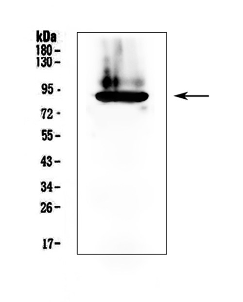 F2 / Prothrombin / Thrombin Antibody - Western blot analysis of Prothrombin using anti-Prothrombin antibody. Electrophoresis was performed on a 5-20% SDS-PAGE gel at 70V (Stacking gel) / 90V (Resolving gel) for 2-3 hours. The sample well of each lane was loaded with 50ug of sample under reducing conditions. Lane 1: human plasma lysate. After Electrophoresis, proteins were transferred to a Nitrocellulose membrane at 150mA for 50-90 minutes. Blocked the membrane with 5% Non-fat Milk/ TBS for 1.5 hour at RT. The membrane was incubated with rabbit anti-Prothrombin antigen affinity purified polyclonal antibody at 0.5 µg/mL overnight at 4°C, then washed with TBS-0.1% Tween 3 times with 5 minutes each and probed with a goat anti-rabbit IgG-HRP secondary antibody at a dilution of 1:10000 for 1.5 hour at RT. The signal is developed using an Enhanced Chemiluminescent detection (ECL) kit with Tanon 5200 system. A specific band was detected for Prothrombin at approximately 85KD. The expected band size for Prothrombin is at 70KD.
