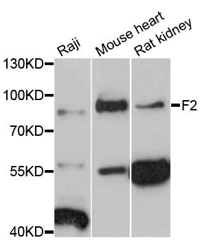 F2 / Prothrombin / Thrombin Antibody - Western blot analysis of extracts of various cell lines, using F2 antibody at 1:3000 dilution. The secondary antibody used was an HRP Goat Anti-Rabbit IgG (H+L) at 1:10000 dilution. Lysates were loaded 25ug per lane and 3% nonfat dry milk in TBST was used for blocking. An ECL Kit was used for detection and the exposure time was 10s.