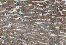 F2 / Prothrombin / Thrombin Antibody - 1:100 staining human liver tissue by IHC-P. The tissue was formaldehyde fixed and a heat mediated antigen retrieval step in citrate buffer was performed. The tissue was then blocked and incubated with the antibody for 1.5 hours at 22°C. An HRP conjugated goat anti-rabbit antibody was used as the secondary.
