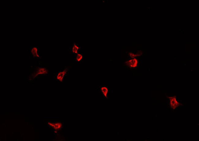 F2 / Prothrombin / Thrombin Antibody - Staining HepG2 cells by IF/ICC. The samples were fixed with PFA and permeabilized in 0.1% Triton X-100, then blocked in 10% serum for 45 min at 25°C. The primary antibody was diluted at 1:200 and incubated with the sample for 1 hour at 37°C. An Alexa Fluor 594 conjugated goat anti-rabbit IgG (H+L) antibody, diluted at 1/600, was used as secondary antibody.
