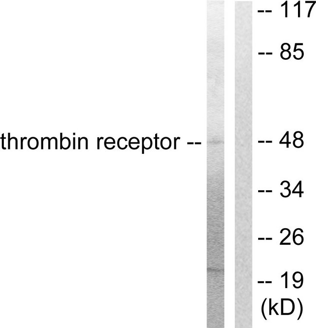 F2R / Thrombin Receptor / PAR1 Antibody - Western blot analysis of lysates from HeLa cells, treated with Nocodazole 1ug/ml 18h, using Thrombin Receptor Antibody. The lane on the right is blocked with the synthesized peptide.