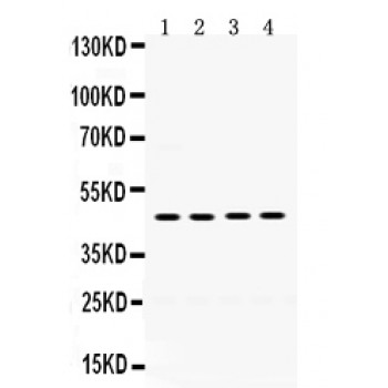 F2R / Thrombin Receptor / PAR1 Antibody - Thrombin Receptor antibody Western blot. All lanes: Anti Thrombin Receptor at 0.5 ug/ml. Lane 1: MCF-7 Whole Cell Lysate at 40 ug. Lane 2: HELA Whole Cell Lysate at 40 ug. Lane 3: 22RV1 Whole Cell Lysate at 40 ug. Lane 4: SW620 Whole Cell Lysate at 40 ug. Predicted band size: 47 kD. Observed band size: 47 kD.