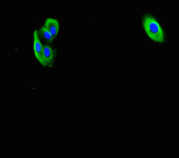 F2R / Thrombin Receptor / PAR1 Antibody - Immunofluorescent analysis of HepG2 cells using F2R Antibody at dilution of 1:100 and Alexa Fluor 488-congugated AffiniPure Goat Anti-Rabbit IgG(H+L)
