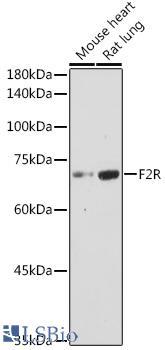 F2R / Thrombin Receptor / PAR1 Antibody - Western blot analysis of extracts of various cell lines, using F2R antibody  at 1:1000 dilution.
Secondary antibody: HRP Goat Anti-Rabbit IgG (H+L)  at 1:10000 dilution.
Lysates/proteins: 25µg per lane.
Blocking buffer: 3% nonfat dry milk in TBST.
Detection: ECL Basic Kit (RM00020).
Exposure time: 180s.