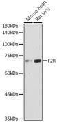 F2R / Thrombin Receptor / PAR1 Antibody - Western blot analysis of extracts of various cell lines, using F2R antibody  at 1:1000 dilution.
Secondary antibody: HRP Goat Anti-Rabbit IgG (H+L)  at 1:10000 dilution.
Lysates/proteins: 25µg per lane.
Blocking buffer: 3% nonfat dry milk in TBST.
Detection: ECL Basic Kit (RM00020).
Exposure time: 180s.
